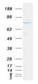 SDS-PAGE (PFKM-473HFL).jpg